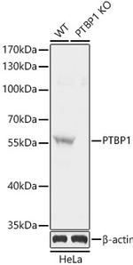 PTBP1 Antibody in Western Blot (WB)