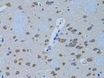 PLCB1 Antibody in Immunohistochemistry (Paraffin) (IHC (P))