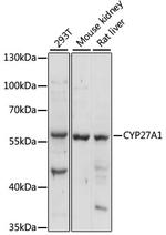 CYP27A1 Antibody in Western Blot (WB)