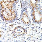 IL13RA2 Antibody in Immunohistochemistry (Paraffin) (IHC (P))