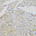 FGFR2 Antibody in Immunohistochemistry (Paraffin) (IHC (P))