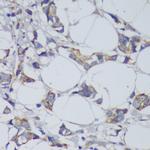 GSK3B Antibody in Immunohistochemistry (Paraffin) (IHC (P))