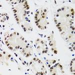 EDF1 Antibody in Immunohistochemistry (Paraffin) (IHC (P))