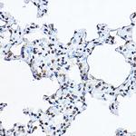 Histone H3.1t Antibody in Immunohistochemistry (Paraffin) (IHC (P))