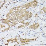 HSC70 Antibody in Immunohistochemistry (Paraffin) (IHC (P))