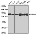 NUP62 Antibody in Western Blot (WB)