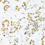 HMGB1 Antibody in Immunohistochemistry (Paraffin) (IHC (P))