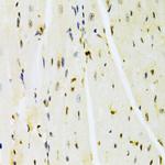 HMGB1 Antibody in Immunohistochemistry (Paraffin) (IHC (P))