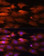 N-WASP Antibody in Immunocytochemistry (ICC/IF)