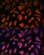 N-WASP Antibody in Immunocytochemistry (ICC/IF)