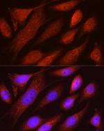 RHOT2 Antibody in Immunocytochemistry (ICC/IF)