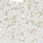 RHOT2 Antibody in Immunohistochemistry (Paraffin) (IHC (P))