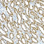 RHOT2 Antibody in Immunohistochemistry (Paraffin) (IHC (P))