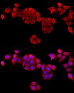 EB1 Antibody in Immunocytochemistry (ICC/IF)