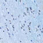 NFkB p100 Antibody in Immunohistochemistry (Paraffin) (IHC (P))