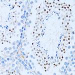 NFkB p52 Antibody in Immunohistochemistry (Paraffin) (IHC (P))