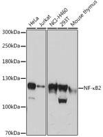 NFkB p100 Antibody in Western Blot (WB)