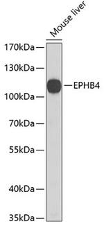 EphB4 Antibody in Western Blot (WB)