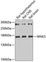 WNK3 Antibody in Western Blot (WB)