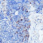 IFNGR1 Antibody in Immunohistochemistry (Paraffin) (IHC (P))