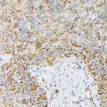 Prodynorphin Antibody in Immunohistochemistry (Paraffin) (IHC (P))