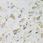 Prodynorphin Antibody in Immunohistochemistry (Paraffin) (IHC (P))