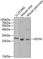 Prodynorphin Antibody in Western Blot (WB)