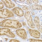 RPL4 Antibody in Immunohistochemistry (Paraffin) (IHC (P))