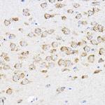 RPL4 Antibody in Immunohistochemistry (Paraffin) (IHC (P))