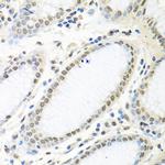 HuR Antibody in Immunohistochemistry (Paraffin) (IHC (P))