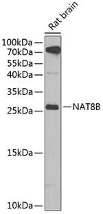 NAT8B Antibody in Western Blot (WB)