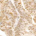 POLD3 Antibody in Immunohistochemistry (Paraffin) (IHC (P))