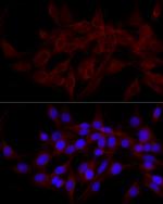 CALCOCO2 Antibody in Immunocytochemistry (ICC/IF)