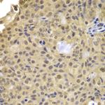 Cyclin A2 Antibody in Immunohistochemistry (Paraffin) (IHC (P))