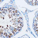 YBX1 Antibody in Immunohistochemistry (Paraffin) (IHC (P))