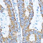 YBX1 Antibody in Immunohistochemistry (Paraffin) (IHC (P))