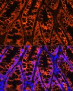 YBX1 Antibody in Immunohistochemistry (Paraffin) (IHC (P))