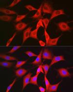 PGD Antibody in Immunocytochemistry (ICC/IF)