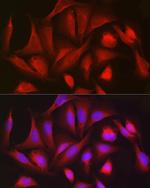 PGD Antibody in Immunocytochemistry (ICC/IF)