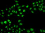 SULT2B1 Antibody in Immunocytochemistry (ICC/IF)