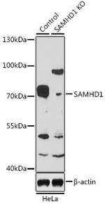 SAMHD1 Antibody in Western Blot (WB)