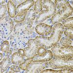 CDH16 Antibody in Immunohistochemistry (Paraffin) (IHC (P))