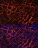 CDH16 Antibody in Immunohistochemistry (Paraffin) (IHC (P))