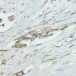 SOCS5 Antibody in Immunohistochemistry (Paraffin) (IHC (P))