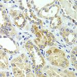 HMGCL Antibody in Immunohistochemistry (Paraffin) (IHC (P))