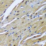 MBNL1 Antibody in Immunohistochemistry (Paraffin) (IHC (P))