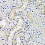 Centrin 3 Antibody in Immunohistochemistry (Paraffin) (IHC (P))