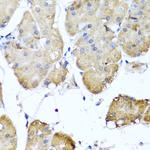 Ninein Antibody in Immunohistochemistry (Paraffin) (IHC (P))