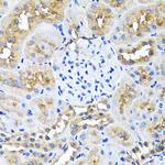 Ninein Antibody in Immunohistochemistry (Paraffin) (IHC (P))