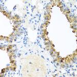 Ninein Antibody in Immunohistochemistry (Paraffin) (IHC (P))